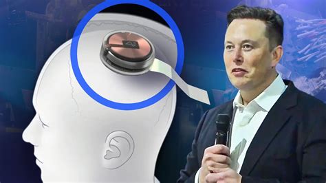 rfid chip in mask|Neuralink: Elon Musk's brain chip firm wins US approval for .